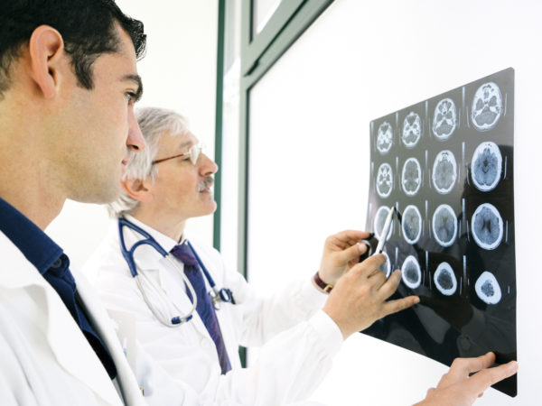 医生们商议大脑的核磁共振扫描。