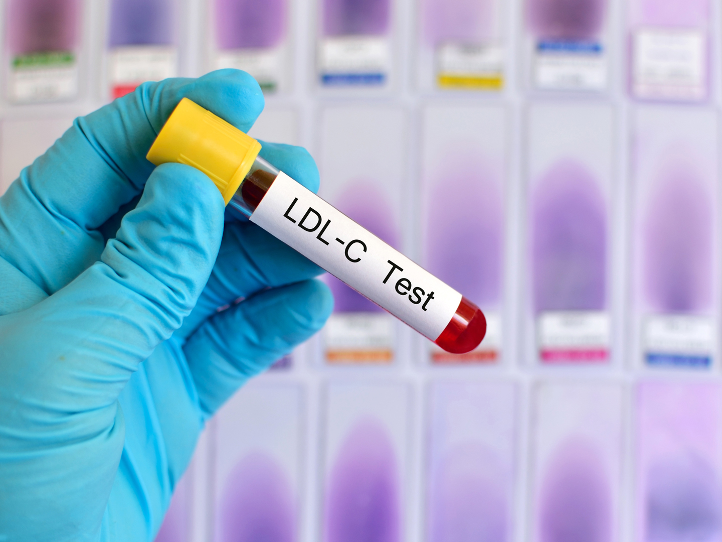 血液样本进行低密度脂蛋白胆固醇(LDL- c)检测