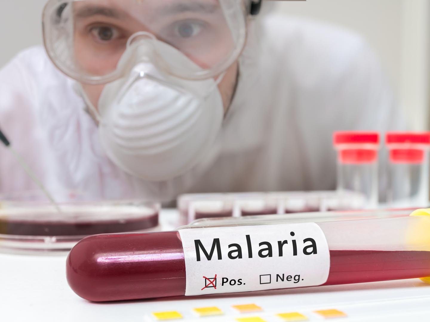 研究人员正在分析携带疟疾的试管。