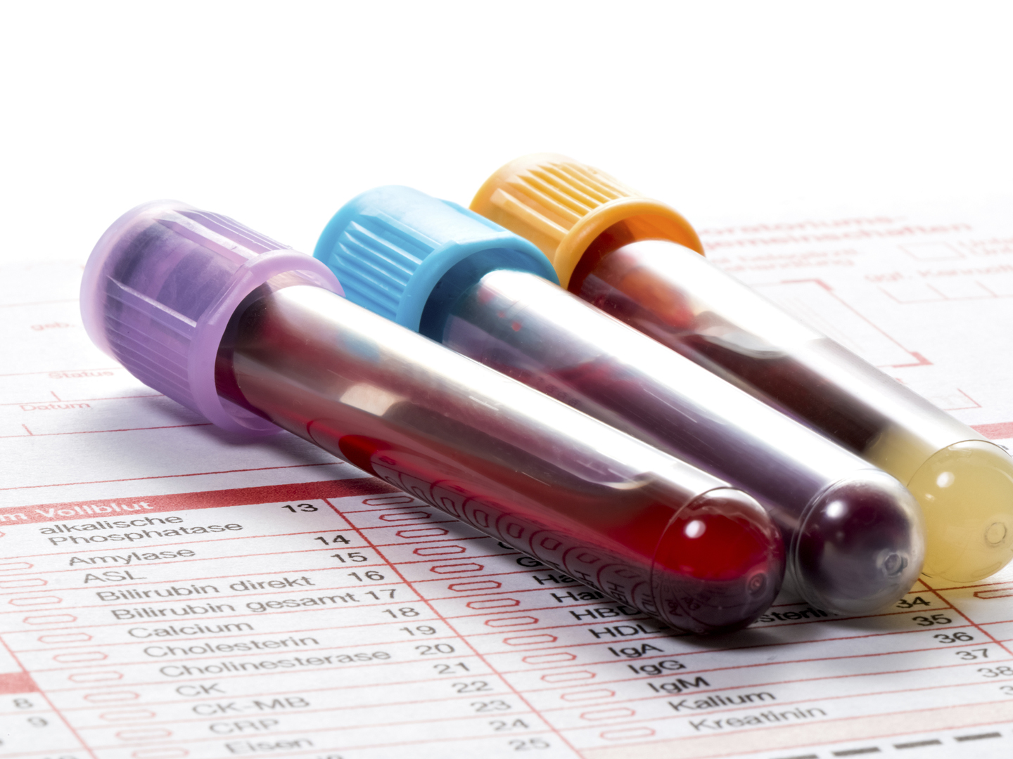 血液样本在实验室表格上，用来检测血液值