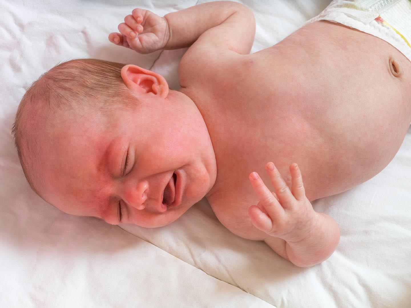 婴儿或新生儿哭闹和绞痛